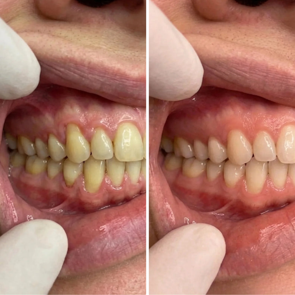 RenuvaMD - Advanced Collagen Complex